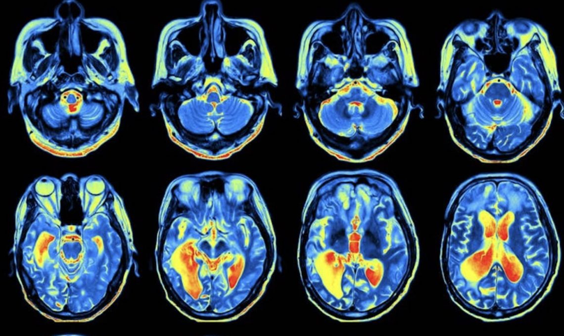 Science As We Know It Can’t Explain Consciousness – But A Revolution Is Coming